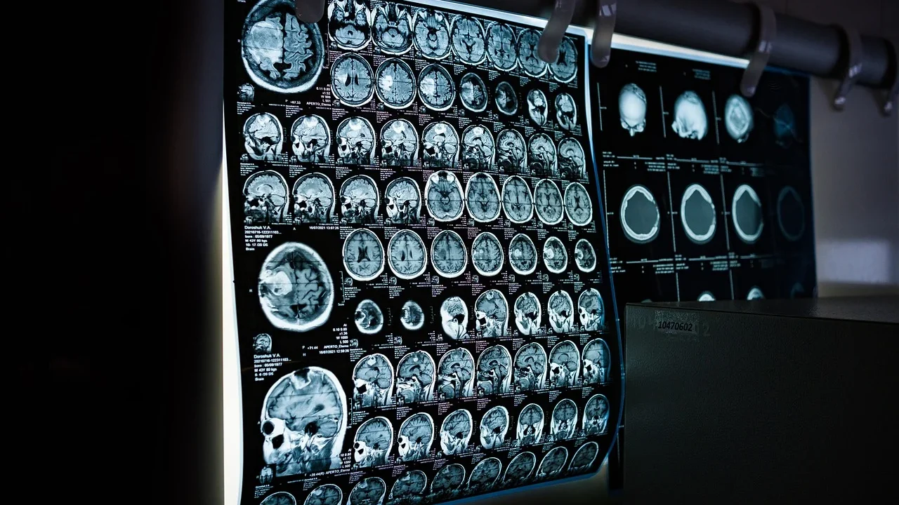 Robot Brain Technology